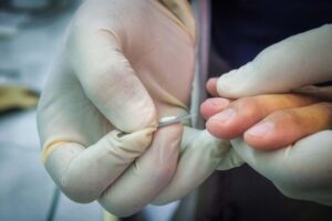 Ganarle la batalla a las arbovirosis